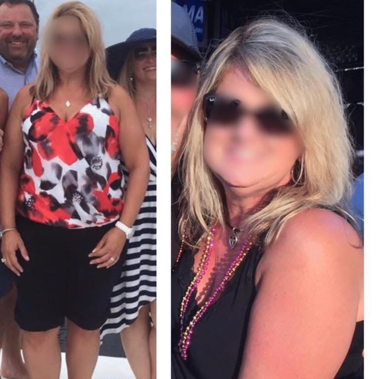 Before Image: Weight Loss - front